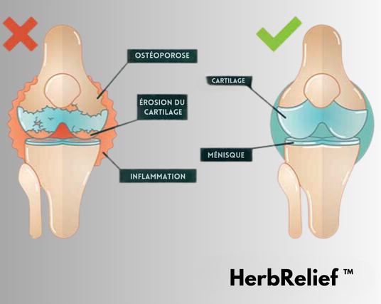 HerbRelief™ Crème pour l'Arthrite